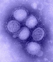 180px-H1N1_influenza_virus.jpg